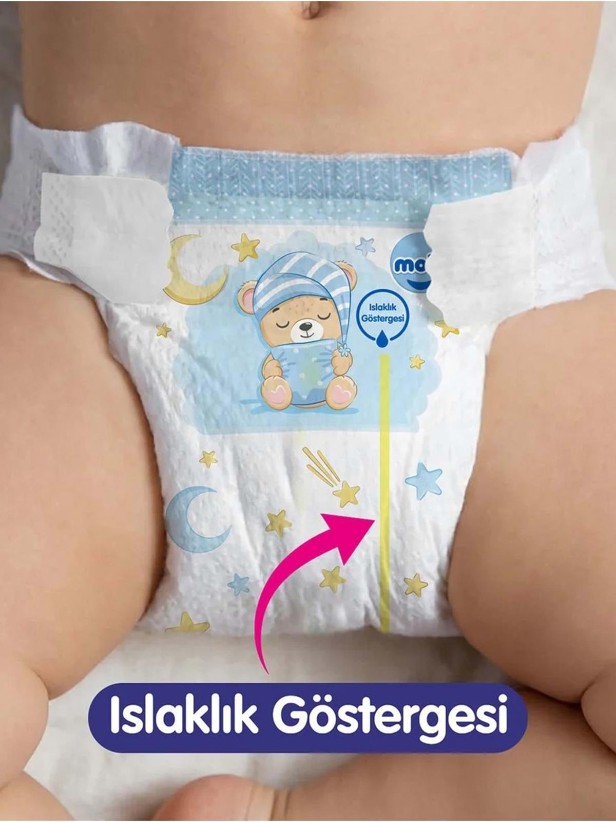 Molfix Sweet Dreams Ultra Fırsat Paket E.Large 48'li